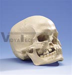 Microcephalic Skull